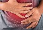 LA ENFERMEDAD AUTOINMUNE QUE AFECTA AL INTESTINO Y SUELE CONFUNDIRSE CON COLON IRRITABLE