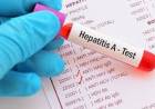 HEPATITIS A Y HEPATITIS E: SE REALIZÓ UNA VIGILANCIA AMBIENTAL EN AGUAS RESIDUALES