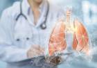 EL CÁNCER DE PULMÓN Y UNA MEDICACIÓN ESPERANZADORA