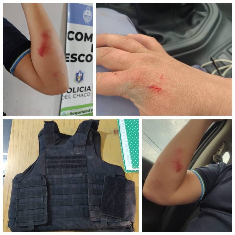 LESIONÓ A DOS EMPLEADOS POLICIALES PARA IMPEDIR SER APREHENDIDO