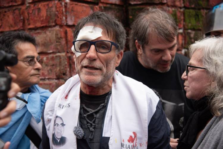 "COMO DECÍA FRANCISCO, PIDEN JUSTICIA SOCIAL Y LES DAN GAS PIMIENTA"