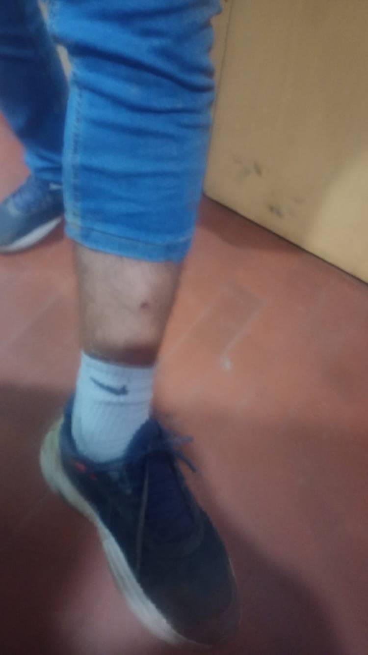 DOS EFECTIVOS RESULTARON HERIDOS TRAS INTENTAR RECUPERAR UNA MOTO