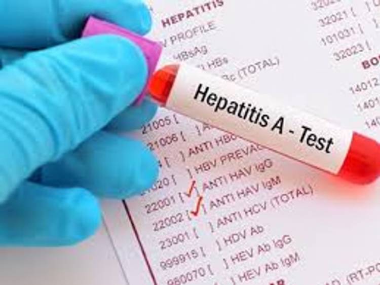 HEPATITIS A Y HEPATITIS E: SE REALIZÓ UNA VIGILANCIA AMBIENTAL EN AGUAS RESIDUALES