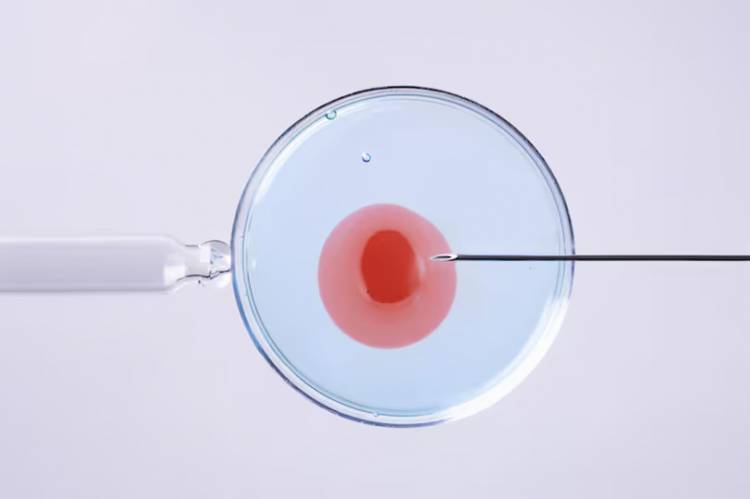 FIV O ICSI: LAS DIFERENCIAS ENTRE LAS DOS TÉCNICAS MÁS UTILIZADAS DE FERTILIZACIÓN ASISTIDA